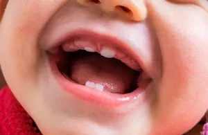 علائم دندان درآوردن نوزاد