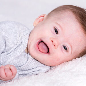 روش‌های تشخیص سندروم داون در نوزاد