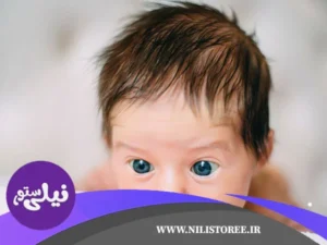 علت ریزش مو نوزاد و کودکان چیست؟ و راه های درمان آن